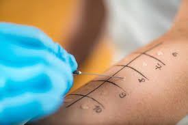 At Home Food Allergy Test Kit: What Works, What Doesn't, and How to Choose (2026)