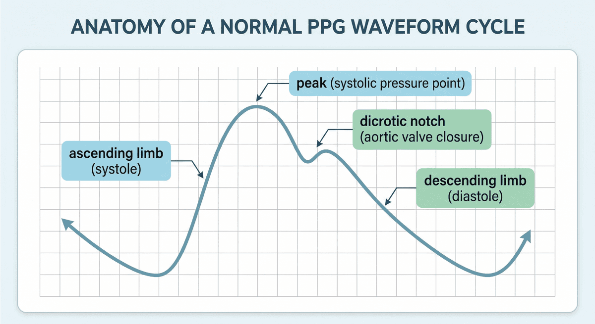 Spo2 Waveform Shape Pulse Oximeter Waveform, Plethysmography & Respiratory Rate: What the ...